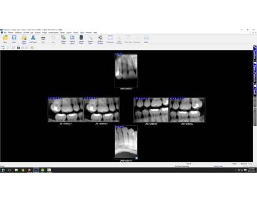Ei-Dental-Sensors-Product-Apteryx-XrayVision-Software