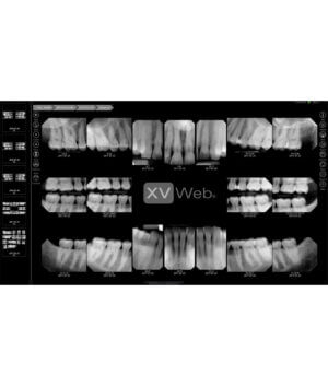 XVWeb-FMX-Screenshot