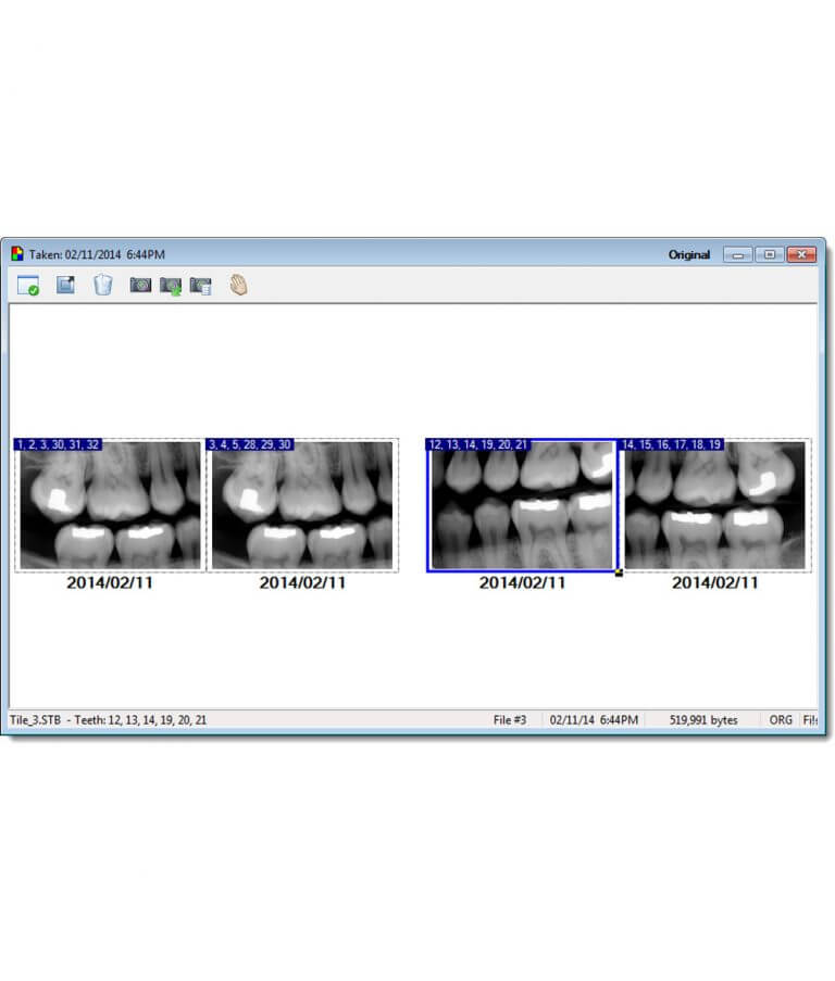 Xrayvision Software Apteryx XrayVision Imaging Software - DentalStore123.com