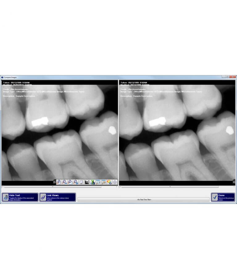 Xrayvision Software Apteryx XrayVision Imaging Software - DentalStore123.com