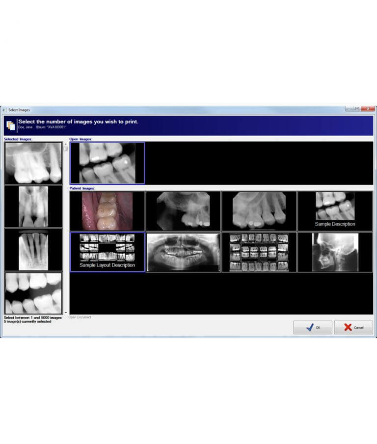 Xrayvision Apteryx XrayVision Imaging Software - DentalStore123.com