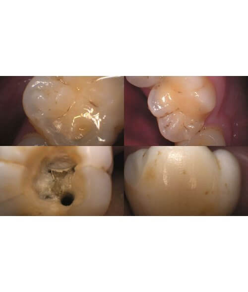 ApexCam-Pro-Sample-Images